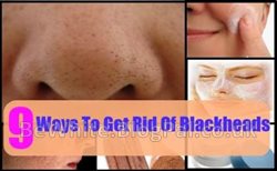 Best skin whitening cream for Malaysian woman