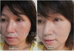 Best skin whitening products for Nigerian people