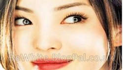 Effective skin whitening for Ugandan woman