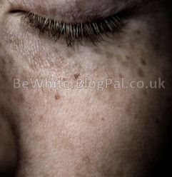 Top skin whitening cream for Congo women