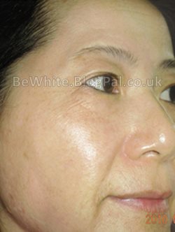 Bleaching skin products for Africans woman