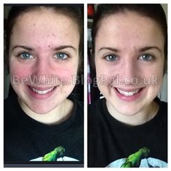 Whitening arm cream for Indian woman