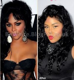 Skin bleaching products for Trinidadians men