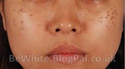 Whitening arm creams for Indian men