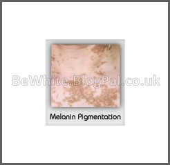 Skin whitening treatments for Somalia women