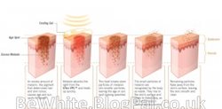 Uneven skin tone cream for Ugandan woman