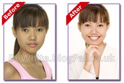 Facial bleaching cream for Black Africans women