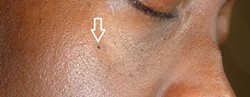 Top skin whitening cream for Black Jamaican woman