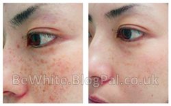 Bleaching creams for Asian men