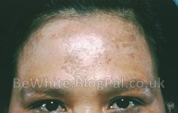 Natural skin whitening tips for Congo woman