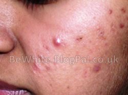 Best whitening products for Zimbabwean woman