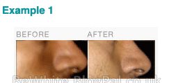 Skin product for Bangladeshi men