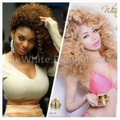Best skin whitening products for Jamaican women
