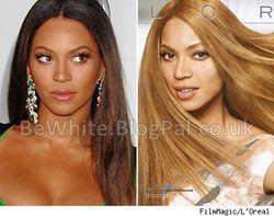 Best skin bleaching for Ugandan men