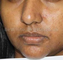 Skin brightener for Africans