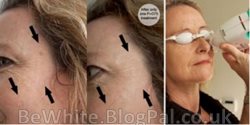 Lightening skin cream for Zambia women
