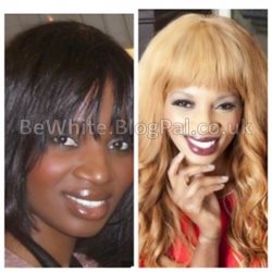 Skin product for Malawian woman