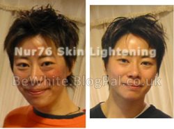 Body skin whitening for Zimbabwean