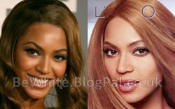 Acne creams for Black Africans women