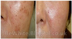 Top whitening creams for Jamaican women