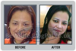 Best body whitening cream for Malawi people