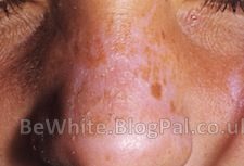 Whitening body creams for Indian