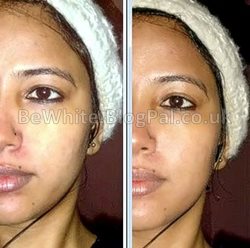 Skin whitening bleach for Black Africans women