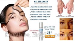 Skin lightening treatments for black skin