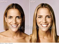 The best skin lightening cream for Zimbabwe