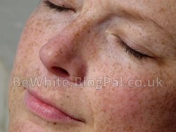 Lightening skin creams for Malawian people