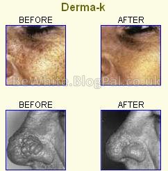 Skin whitening body cream for Somalia woman