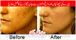 Lightening skin cream for Malaysian men