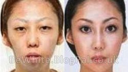Whitening body for Trinidadians men