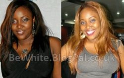 Natural skin bleaching for black skin