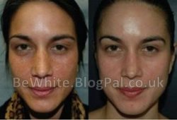 Body whitening lotion for Somali