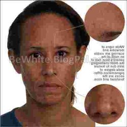 Bleaching neck creams for Uganda women