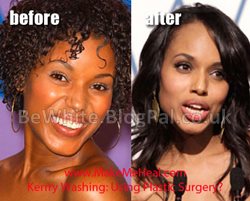 Whitening black skin creams for Zimbabwe