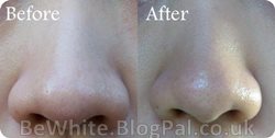 Skin lightening treatments for Zambia woman
