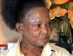Lightening face cream for Jamaican people