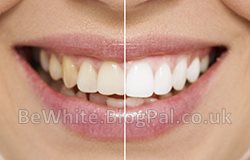 Whitening skin creams for Black Trinidadians men