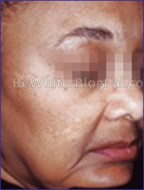 Whitening body creams for Congolese