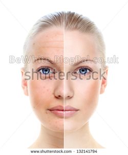 Best whitening creams for Pakistani