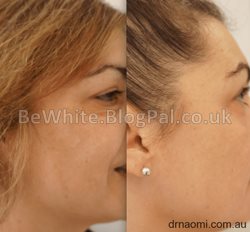 Skin treatments for Ugandan woman