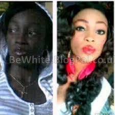 Bleaching black skin cream for Malawi people