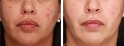 Natural skin lighteners for Ghana men