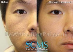 Whiten face for Congo woman