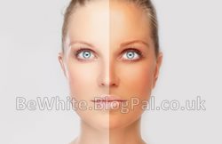 Dark spots remover creams for Black Trinidadians men