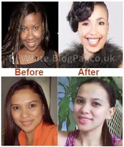 Bleaching skin cream for Black women
