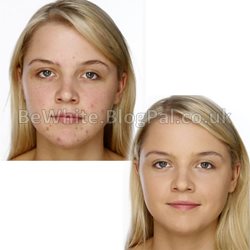 Whitening facial cream for Black Trinidadians people