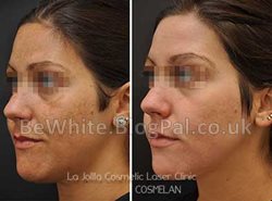 Kojic acid products for Malawian people